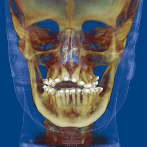 Radiología Dental 3D Málaga